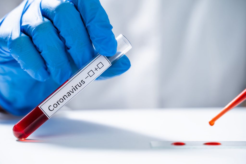 Sanidad suma 616 nuevos casos de coronavirus y 2.918 altas en la Comunitat Valenciana