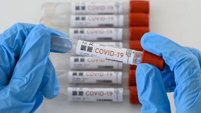 Dos nuevos contagios por Covid-19 en Villena